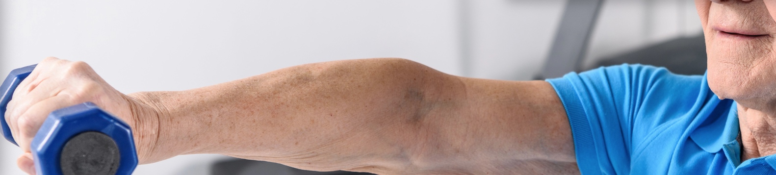 Una función cardiorrespiratoria elevada se asocia a un menor riesgo de demencia, según investigación publicada del British Journal of Sports Medicine